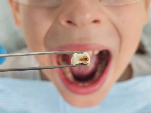 Best Emergency Cosmetic Dentistry in Palm City, FL